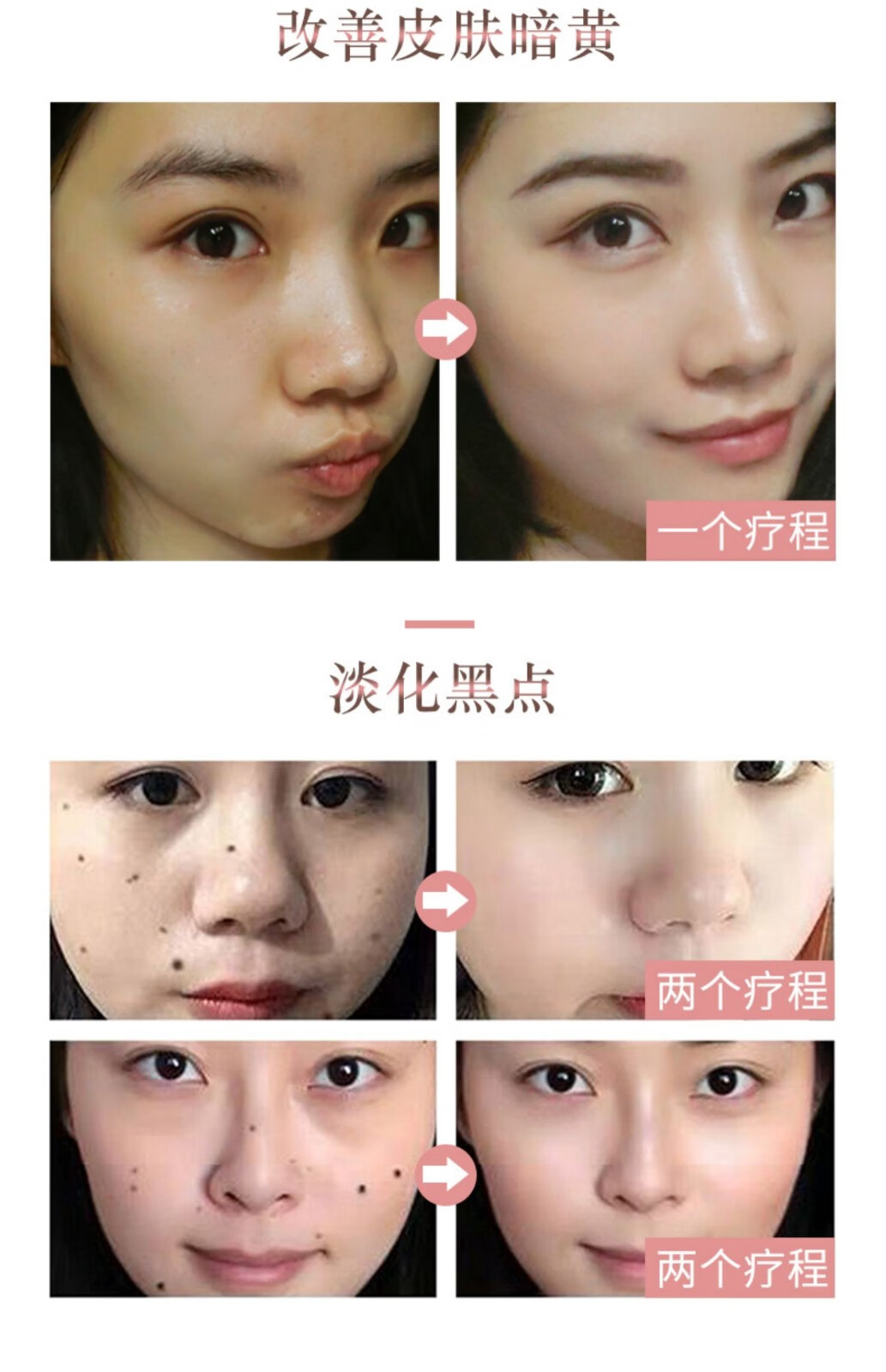 NHFOUYOU祛斑精华油点黑点玫瑰净颜精油补水美白提亮肤色溶斑精华美白淡斑 1瓶【体验装】