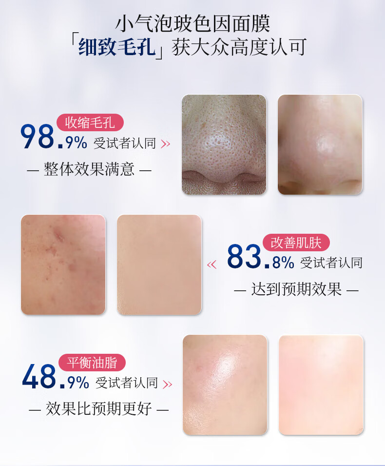 白云山 收缩毛孔面膜清洁祛痘黑粉刺头玻色因小气泡睡眠面膜200ml