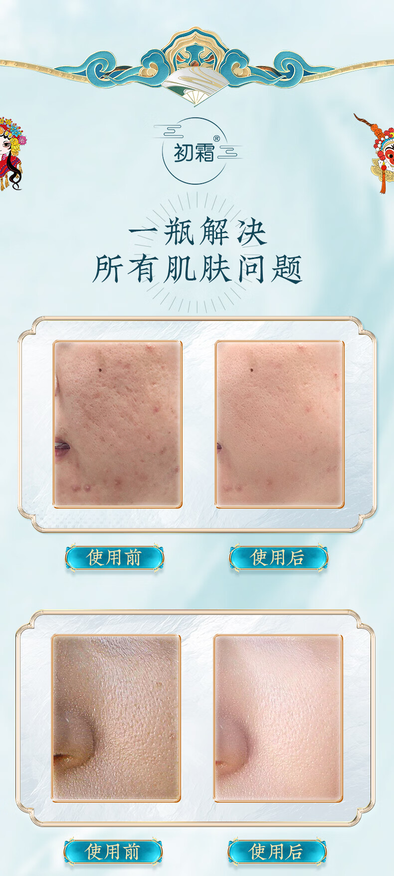 初霜【国妆特证】氨基酸深层清洁毛孔祛痘除螨洁面乳美白淡斑消印男女 国潮组合【一生所爱.天作之合】 氨基酸温和配方.敏感肌.孕期适用