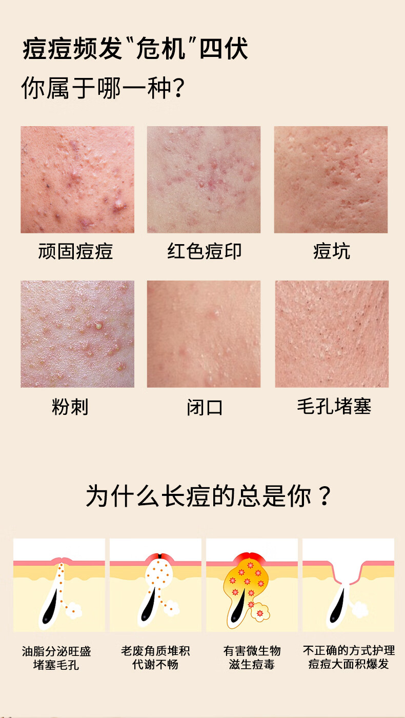 仁和匠心草本植萃祛痘膏30g 去痘膏淡化痘印痘疤痘坑青春痘闭口粉刺精华膏去痘痘膏男女学生用