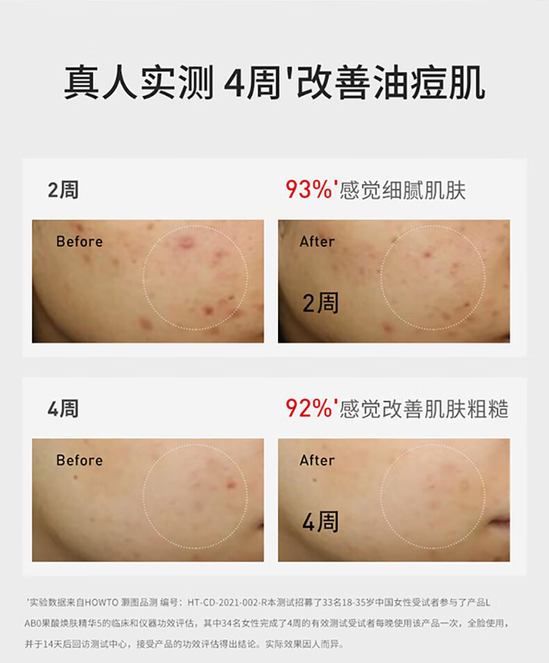 城野医生	（Dr.Ci:Labo）轻酸瓶30ml 果酸+5%杏仁酸控油痘精华液