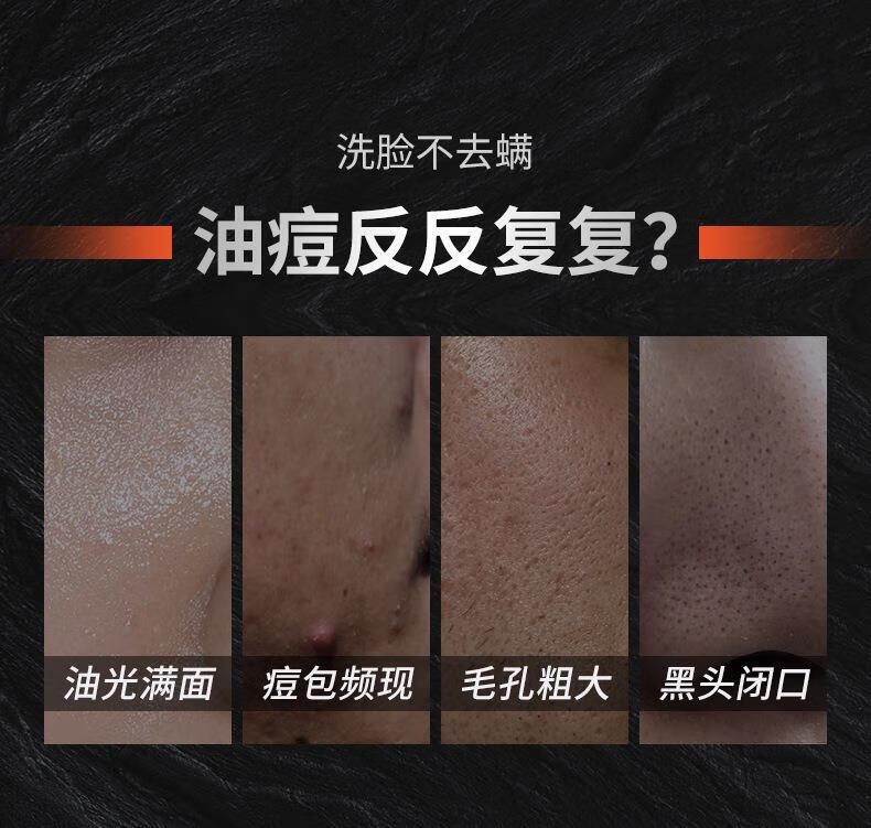冰菊（Bing Ju）超大瓶男士洗面奶火山泥矿物清洁抗痘控油淡化痘印黑头洁面乳500g