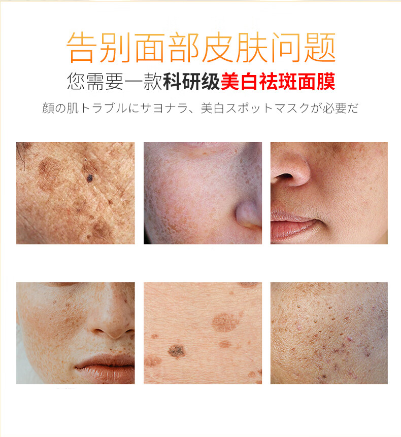 Jea·Love韩国配方美白面膜祛斑淡斑烟酰胺补水保湿提亮肤色去黄控油男女