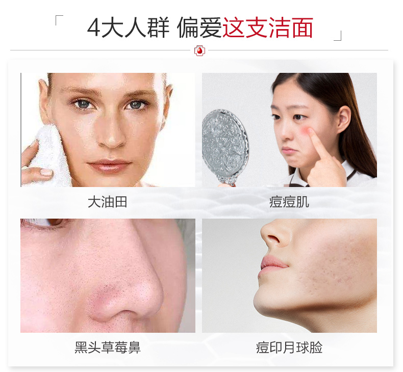 薇诺娜净痘清颜洁面乳80g（弱酸性温和洁面 抑制油脂分泌 收敛毛孔 祛痘控油洗面奶女 ）