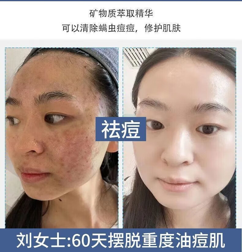 YMVLSD美白洗面奶烟酰胺净颜小野美白洁面乳博士控油改善暗沉亮肤洗面奶