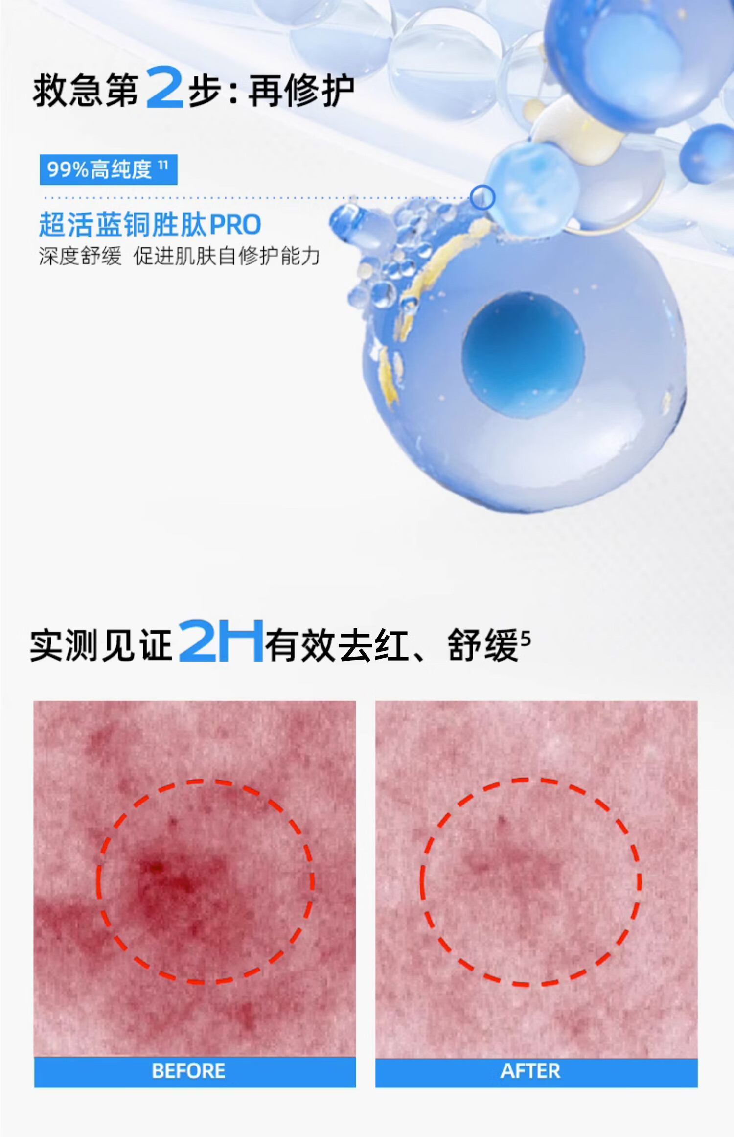 米蓓尔轻龄紧致修护涂抹式蓝绷带面膜2.0补水舒缓修护225g