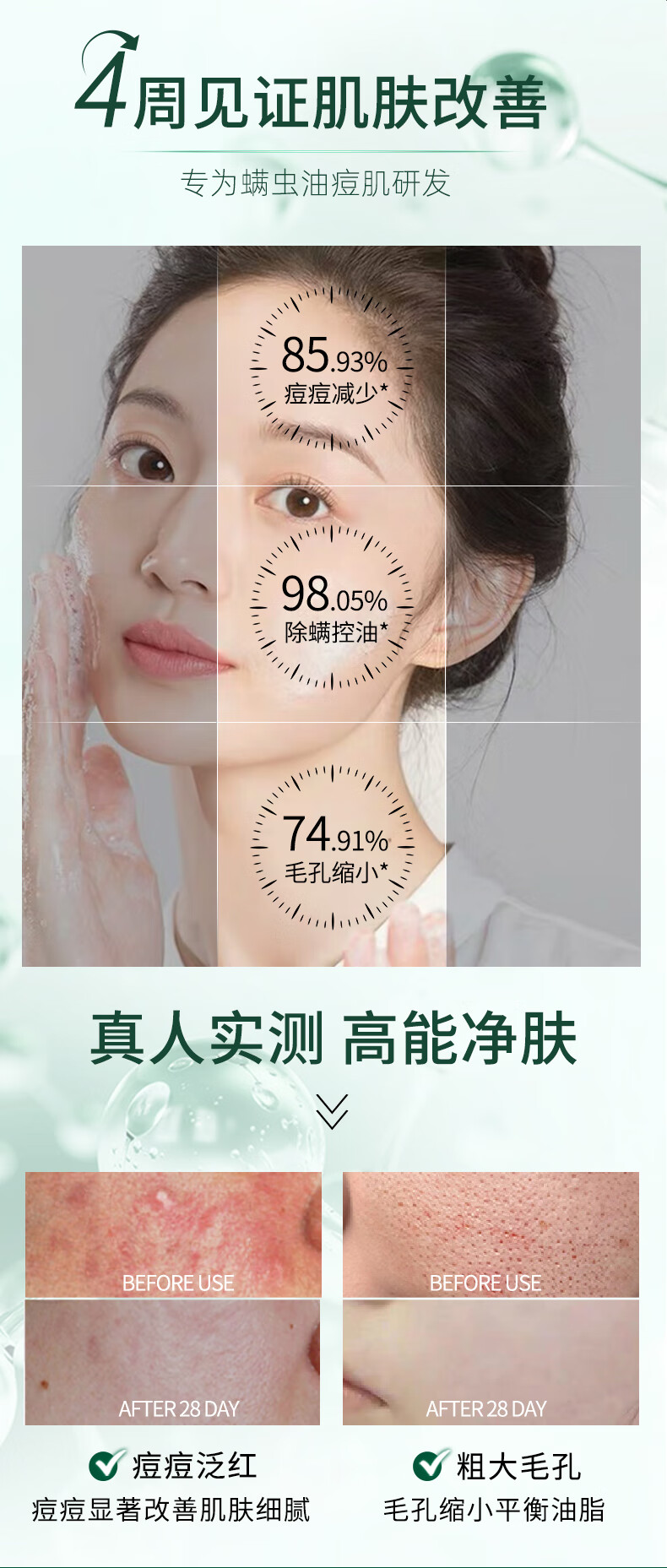 BAINHR水杨酸洗面奶南方医科大学清爽控油缓解痘痘肌深层清洁收缩毛孔