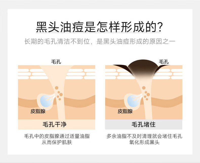 STVKG清洁面膜泥膜去深层清洁黑白头收缩毛孔涂抹男女100g