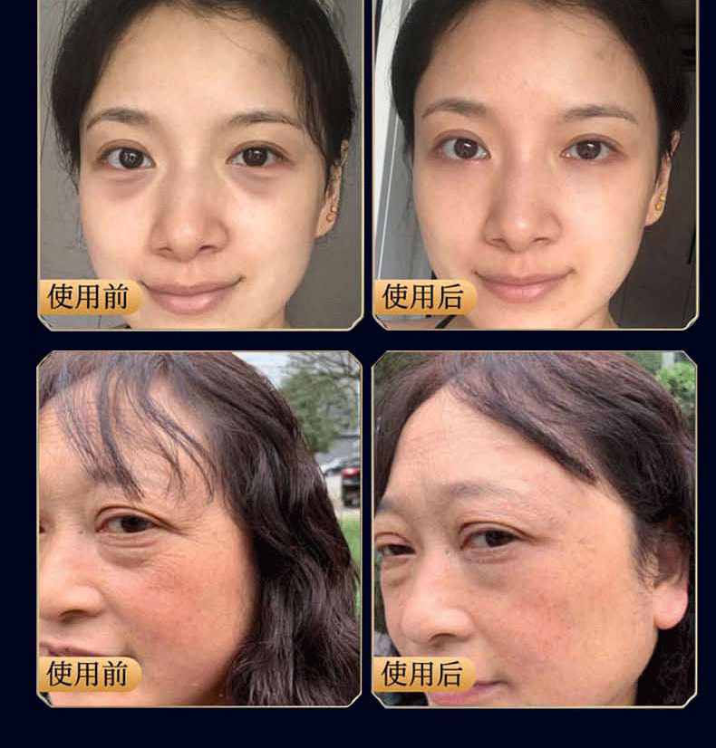 广药白云山 类蛇毒眼霜眼袋黑眼圈淡化细纹脂肪粒鱼尾纹提拉紧致眼纹男士女30g