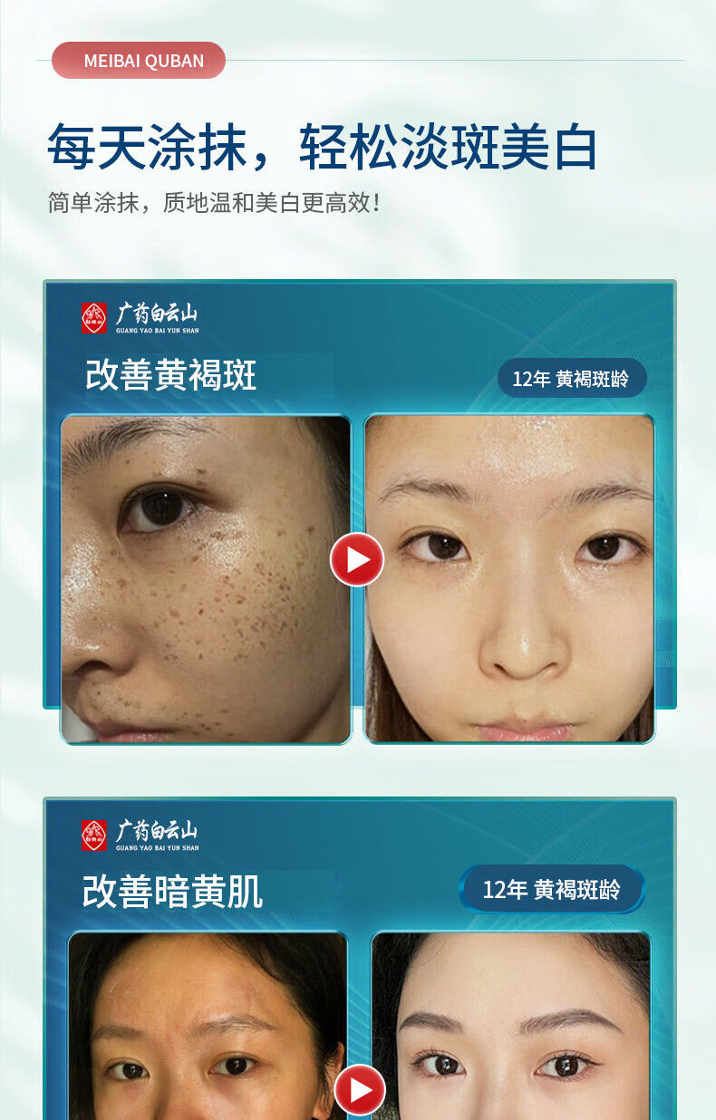 广药白云山祛斑美白面膜补水黄褐斑老人斑雀斑晒斑保湿男女通用120g	