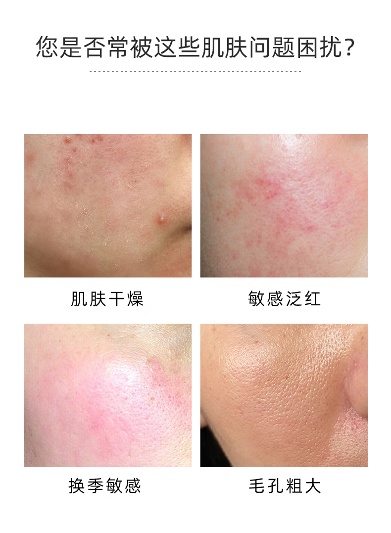 敷尔佳 B5舒缓修护贴26g*5贴/盒 补水保湿舒缓修护