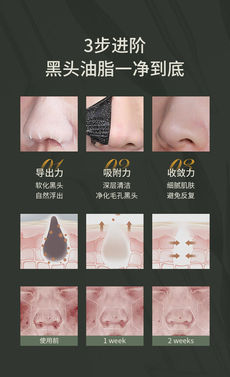 SKISGEM 德国进口吸去黑头祛痘面膜鼻贴套装收缩毛孔清洁去粉刺男女 去黑头收毛孔3件套