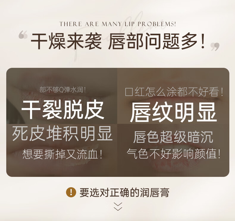 维特丝（vetes）润唇膏女保湿滋润补水防干裂死皮改善唇色唇纹无色可打底男女通用 保湿润唇膏2支
