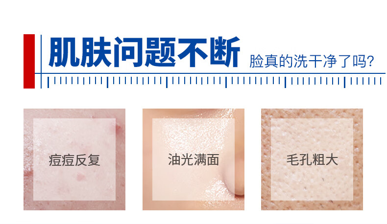 芙清密钥水杨酸洗面奶祛痘温和氨基酸系洁面乳深层清洁控油保湿100g