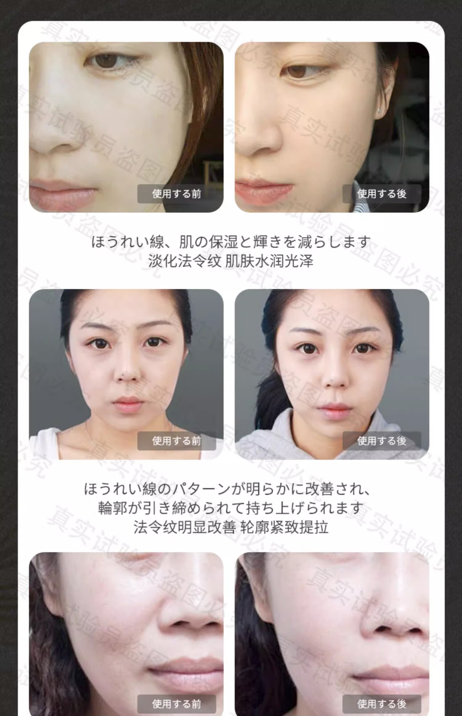 NHFOUYOU法令纹贴补水抗皱提拉紧致消除嘴角纹紧致肌肤法令纹去除神i器 1盒【体验装】