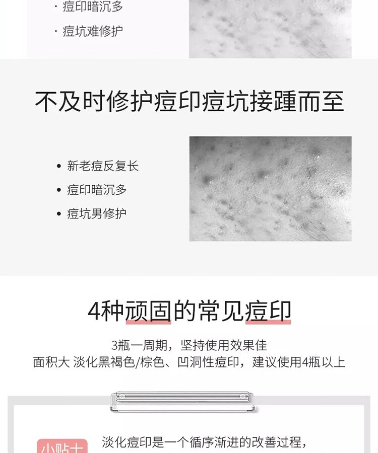南京同仁堂祛痘膏芦荟祛痘凝胶收缩毛孔闭口粉刺淡化痘印痘肌男女青春痘20g