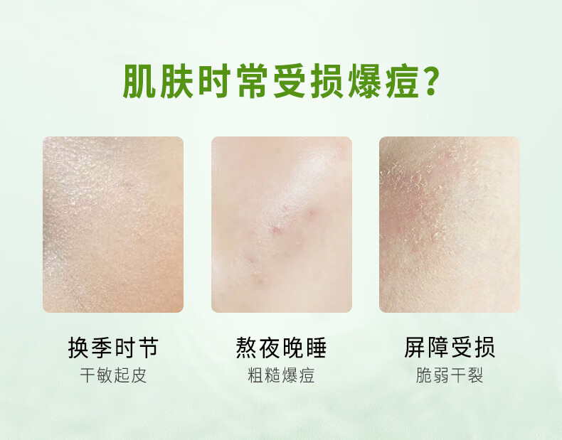 美迪惠尔（Mediheal）艾叶舒缓修护水感面膜20ml*15片/盒（舒缓呵护 补水保湿）韩国