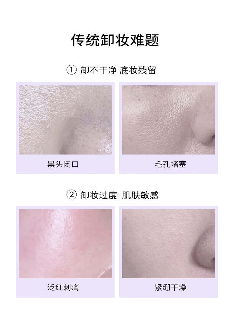AKF卸妆水500m l男女士脸部温和舒缓深层清洁不刺激卸妆乳眼唇