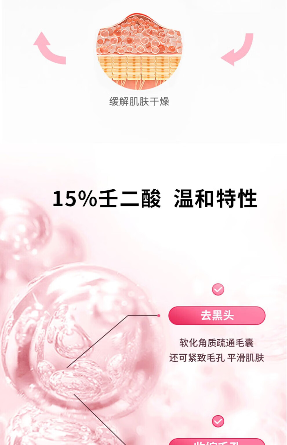 YMVLSD壬二酸15%凝胶水杨酸细致毛孔霜凝露痘印淡化去黑头闭口粉刺乳膏