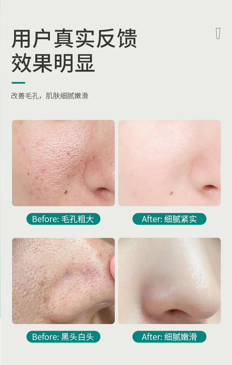 碧素堂BST洗面奶乳糖酸清洁黑头粉刺收毛孔油皮痘肌敏感肌男女祛缩学生 1瓶装【贈起泡网】2瓶起贈洗脸刷