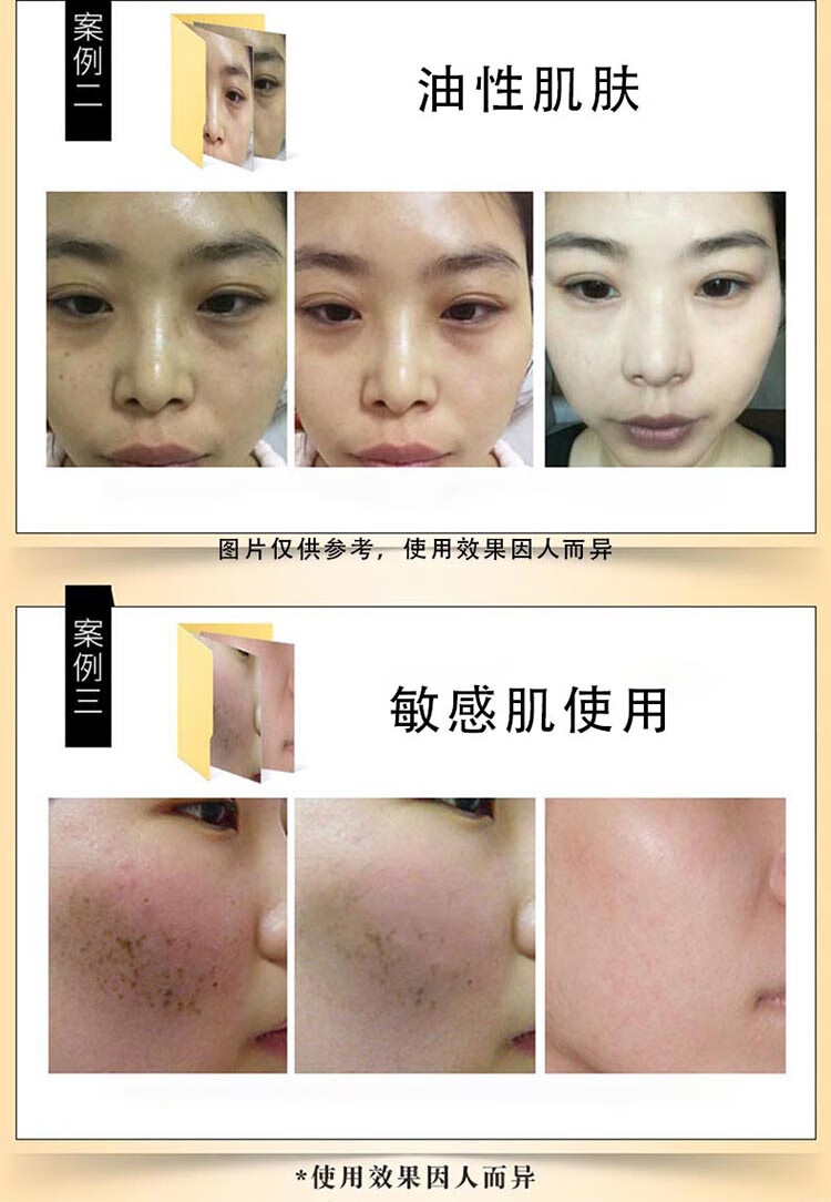南京同仁堂美白祛斑精华液去斑淡化斑精华原液去老年斑黄褐斑妊娠斑祛斑产品男士女士用 100ml