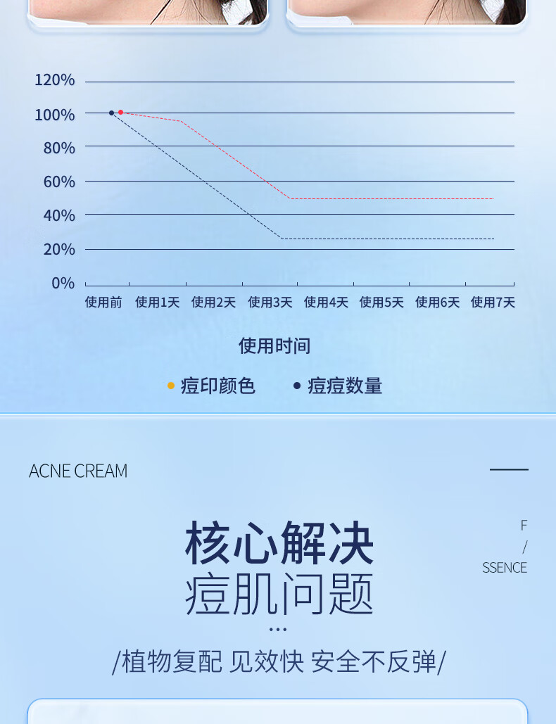 ORGINESE甘草植萃祛痘精华乳膏去闭口粉刺额头红肿痘痘姨妈痘下巴抗痘凝胶
