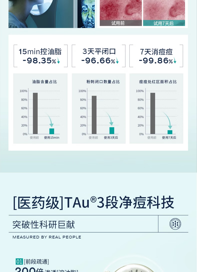 ANFANY痘痘点涂棒精华液水杨酸修护痘改善肌闭口粉刺痘印痘坑20支/盒