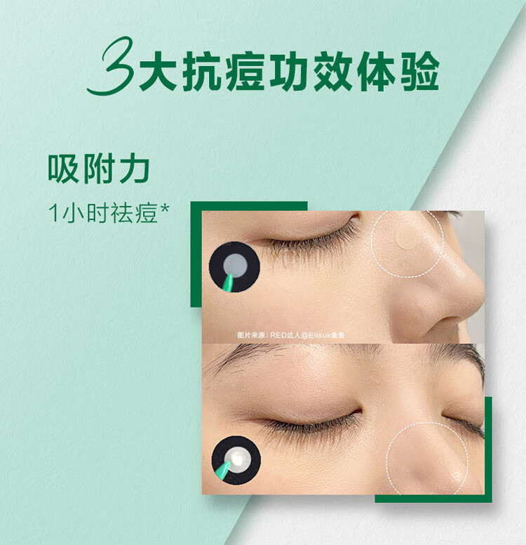 曼秀雷敦（Mentholatum）乐肤洁隐形痘贴 痘痘贴轻薄遮瑕可上妆吸脓抗痘 日夜可用52片
