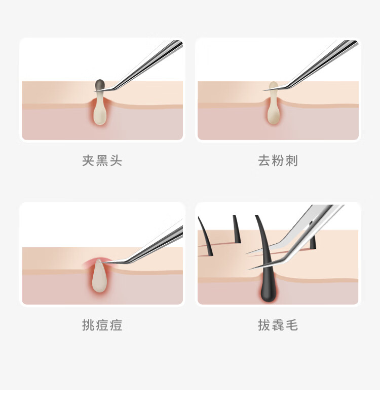 妙倩德国瑞士5号细胞夹斜嘴夹粉刺针黑头针挤痘痘工具美容镊子脂肪粒