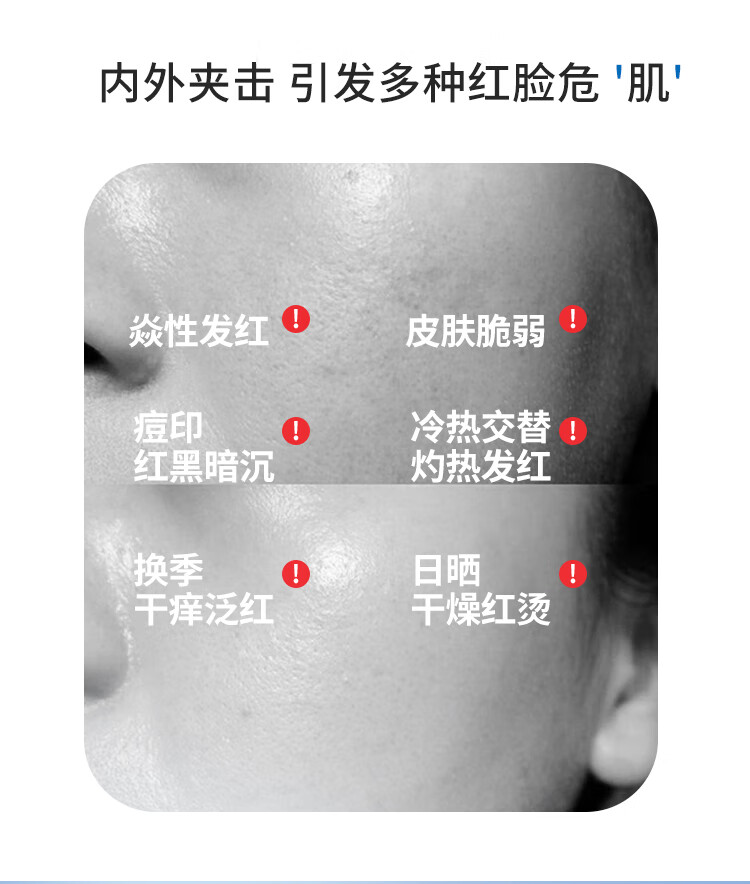 皮宝舒缓修护精华液面部精华肌肤屏障维稳保湿小蓝瓶30ml*2