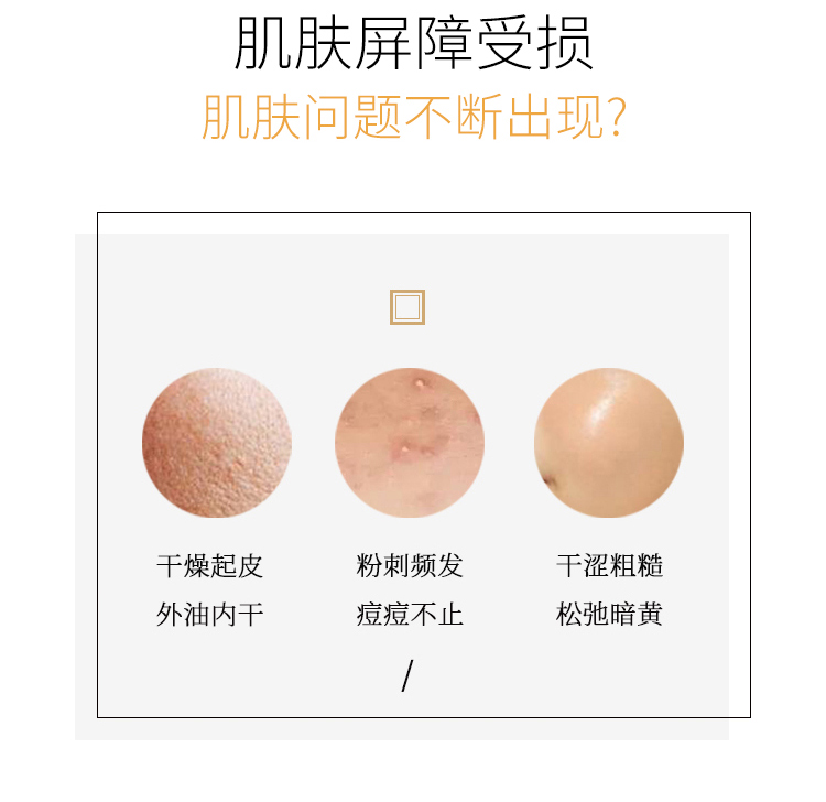 春娟黄芪保湿修复精华液30ml深层保湿 改善细纹 提拉紧致 调理肤色