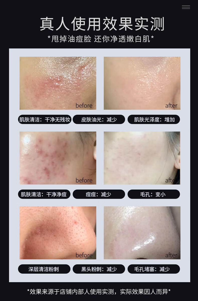 仁和植物净颜洗面奶男女士控油氨基酸深层清洁补水保湿温和痘肌祛角质抗痘去黑头收缩毛孔氨基酸洁面乳160g