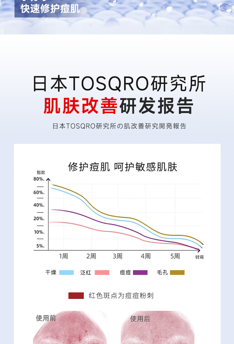 彤生泉面膜修复淡化祛痘印美白补水保湿收缩毛孔熬夜舒缓修护女男士专用 舒缓修复面膜1盒（10片）