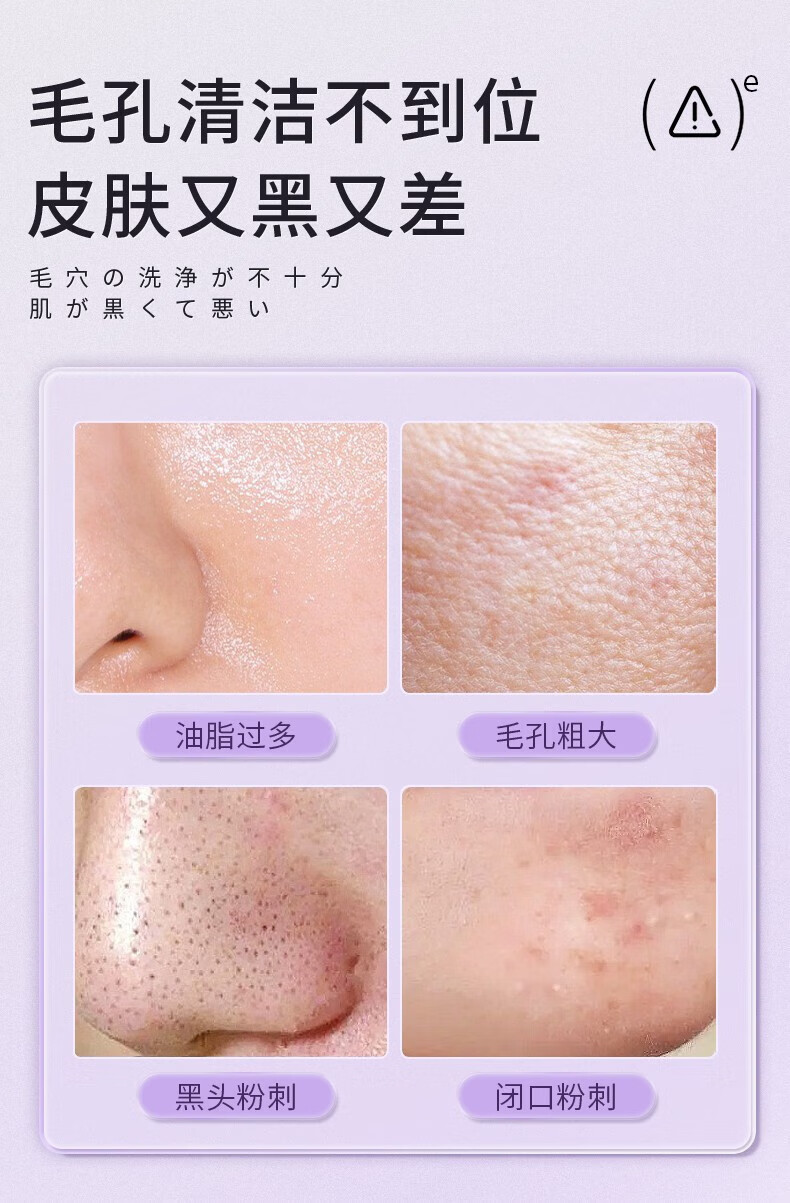 YMVLSD壬二酸紫苏清肤净颜泥膜棒去黑头粉刺收缩毛孔清洁涂抹面膜30g