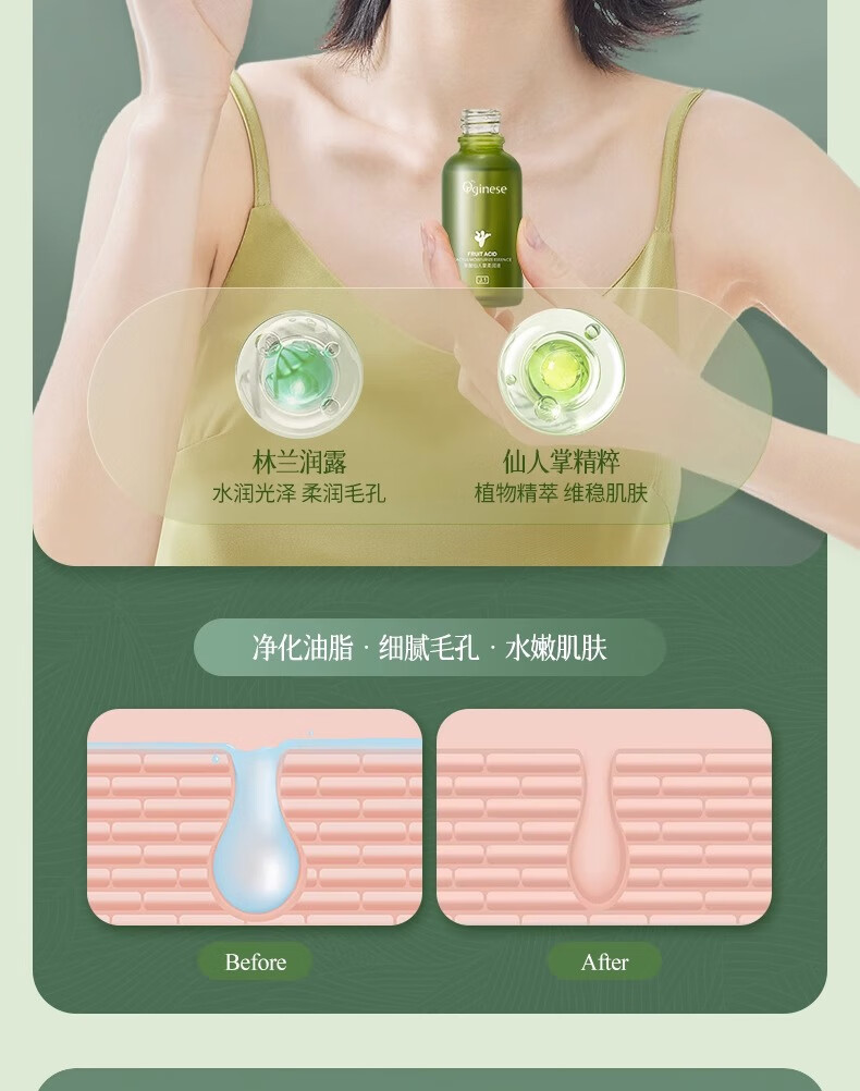 ORGINESE果酸仙人掌撕拉式吸去黑头面膜三件套黑头导出泥膜收缩毛孔