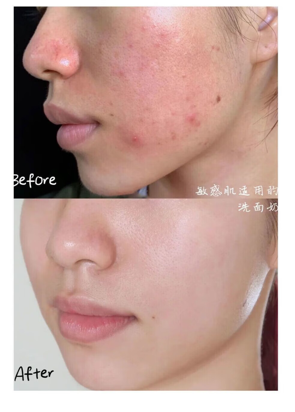 YMVLSD美白洗面奶烟酰胺净颜小野美白洁面乳博士控油改善暗沉亮肤洗面奶