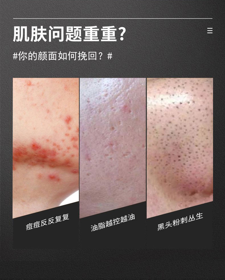 广药白云山氨基酸洗面奶控油祛痘除螨去黑头缩毛孔深层清洁洁面乳两瓶装300g