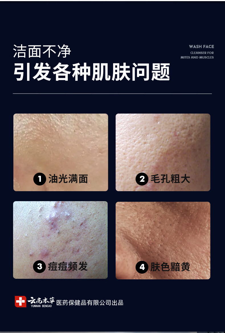云南本草氨基酸洗面奶美白透亮抗痘去黑头深层清洁收缩毛孔补水保湿洁面乳150ml