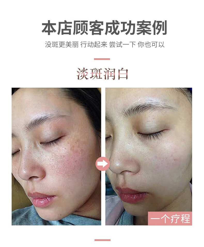 NHFOUYOU祛斑精华油点黑点玫瑰净颜精油补水美白提亮肤色溶斑精华美白淡斑 1瓶【体验装】