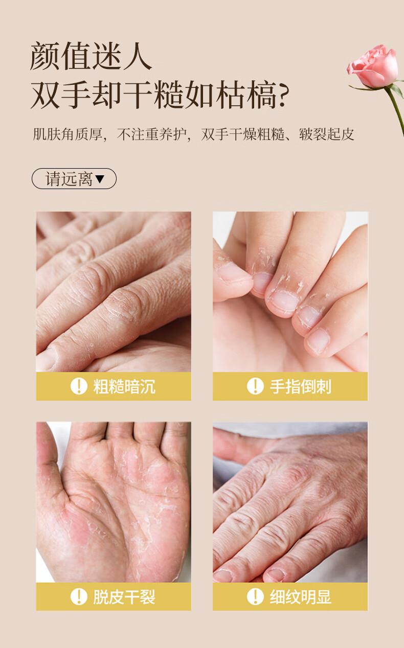 诺珊娜 澳洲进口玫瑰护手霜70g 补水保湿防干裂滋润清爽 男女士四季适用