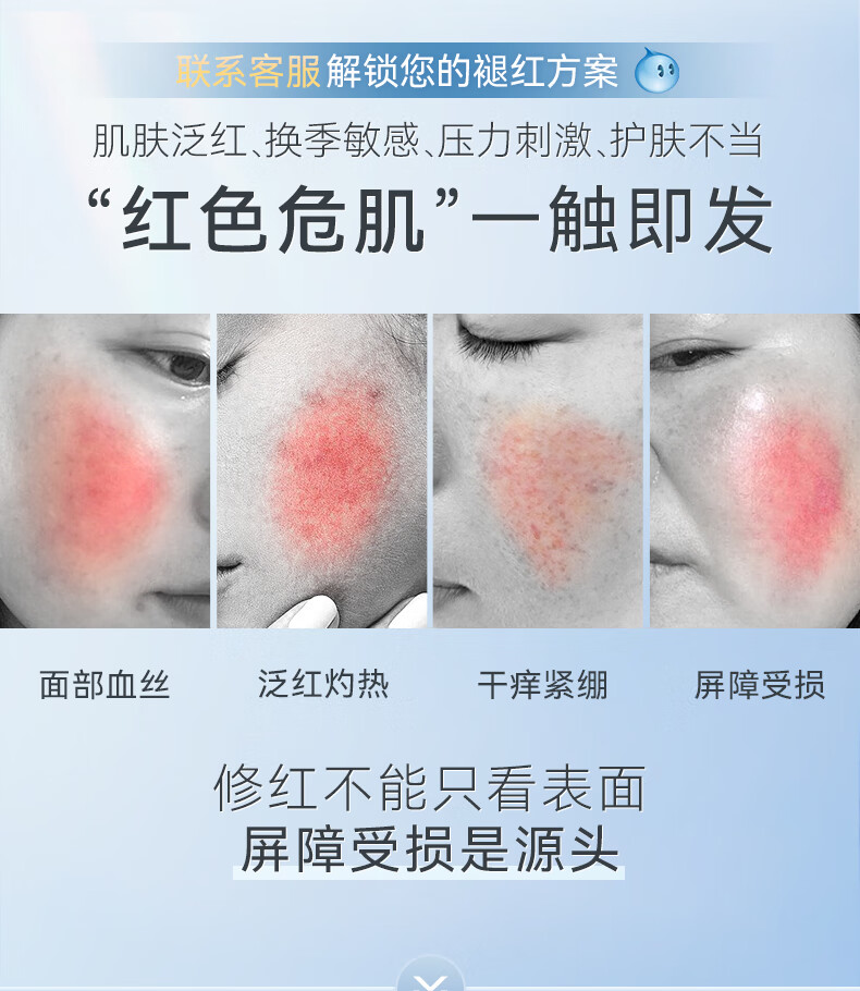RSAS 面霜脸颊泛红保湿霜改善敏感肌肤修护特护霜 30g/瓶