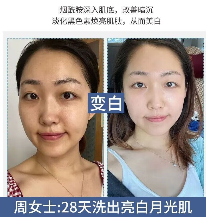 YMVLSD美白洗面奶烟酰胺净颜小野美白洁面乳博士控油改善暗沉亮肤洗面奶