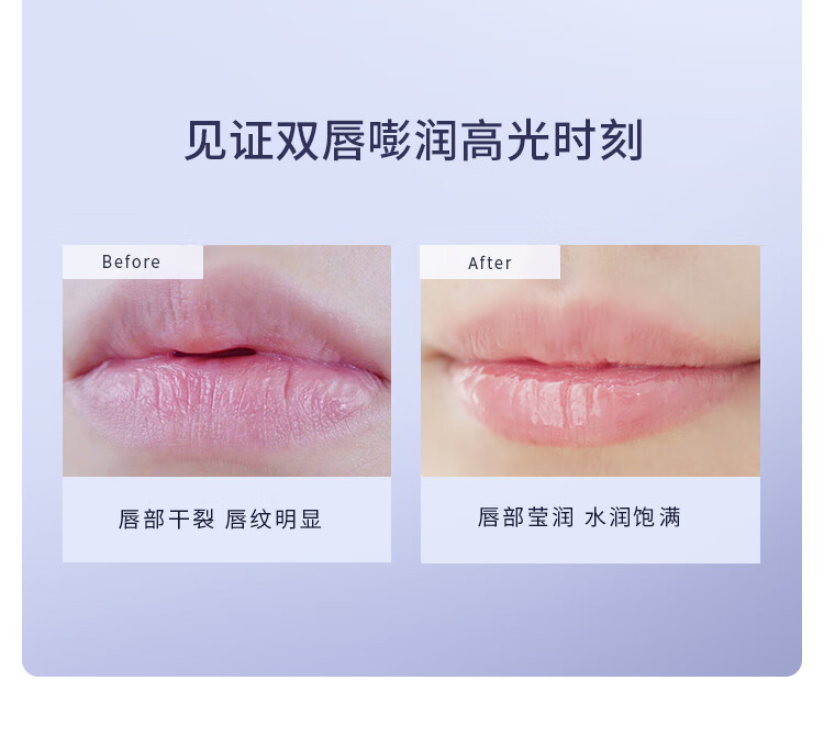 菜鸟和配方师B5胚芽唇部美容精华液 淡化唇纹补水保湿滋润去死皮润唇膏女 5ml（旧款）