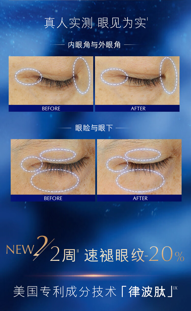 雅诗兰黛眼面2件套(棕瓶精华30ml+棕瓶眼霜15ml)化妆品护肤礼盒护肤套装
