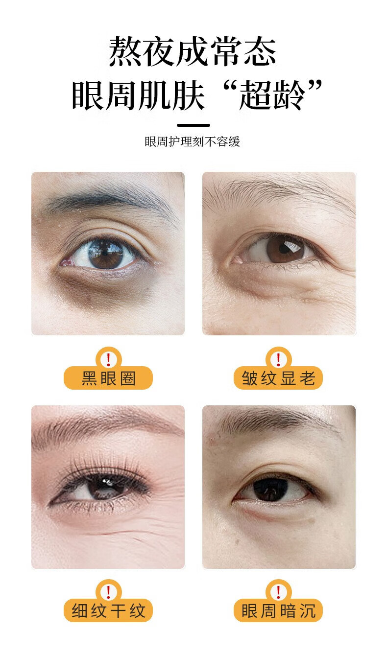 Binee紧致抗皱眼部a醇精华油眼周细纹黑眼圈眼袋按摩滚珠眼部精华8ml