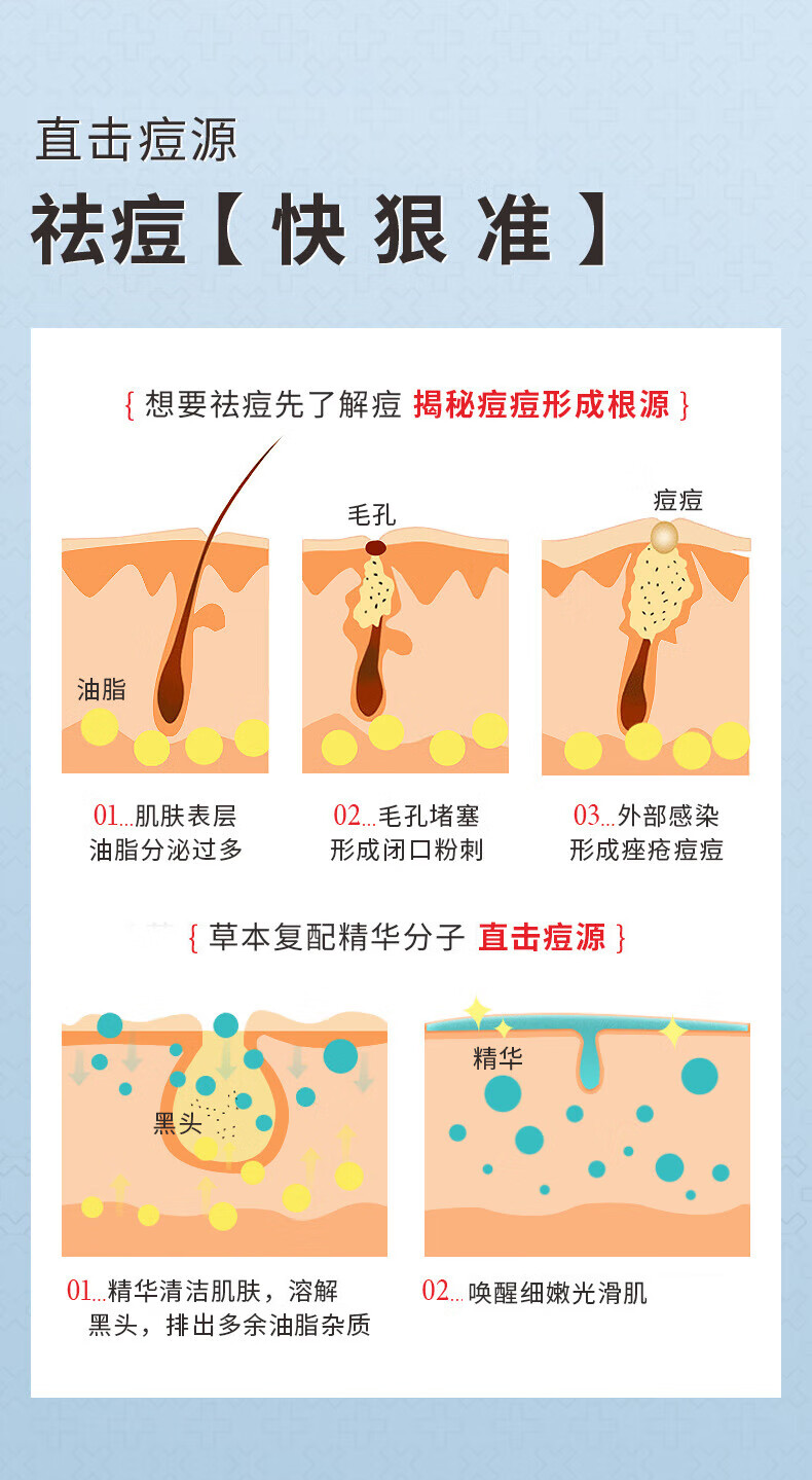 娅芝清肌净颜祛痘膏30g痘印水杨酸壬二酸去痘凝胶青春痘学生