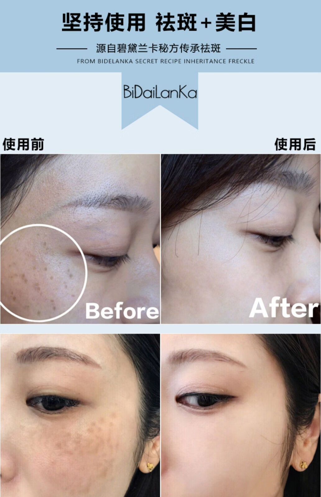 NHFOUYOU祛斑精华油点黑点玫瑰净颜精油补水美白提亮肤色溶斑精华美白淡斑 1瓶【体验装】