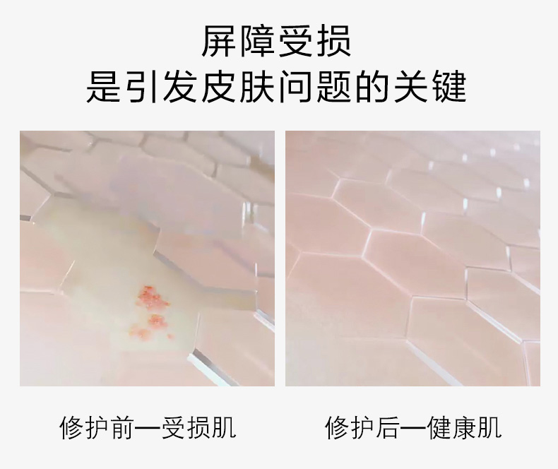薇诺娜（WINONA）舒敏保湿洁面乳80g 氨基酸洗面奶男女面部清洁