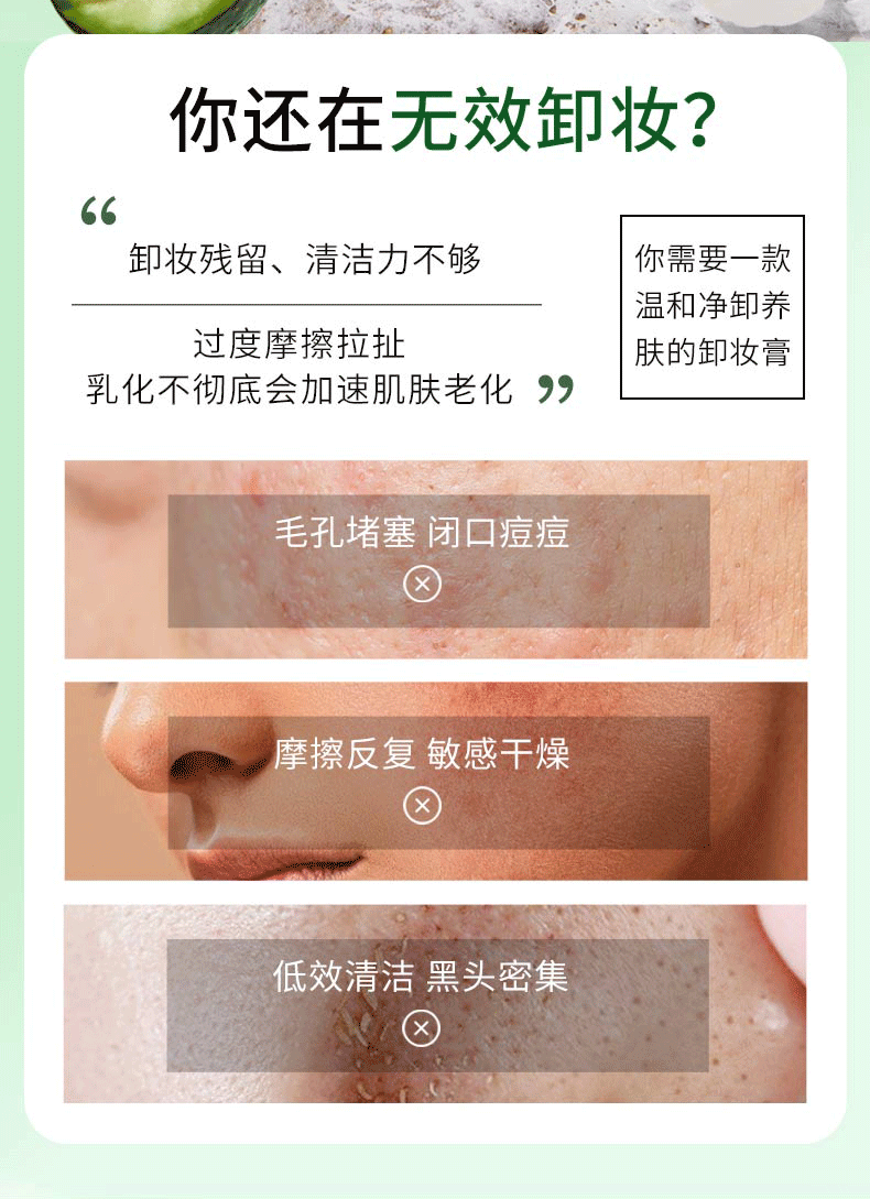 洛语杭希牛油果卸妆膏卸妆洁面快速乳化深层净澈毛孔面部眼唇卸不闷痘