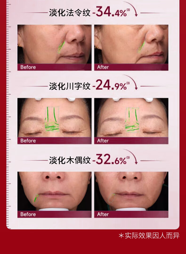 同仁堂淡纹抗皱面霜衰老提拉紧致淡化细纹法令纹抬头纹去除男女士50g
